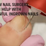 How Nail Surgery Can Help with Painful Ingrown Nails